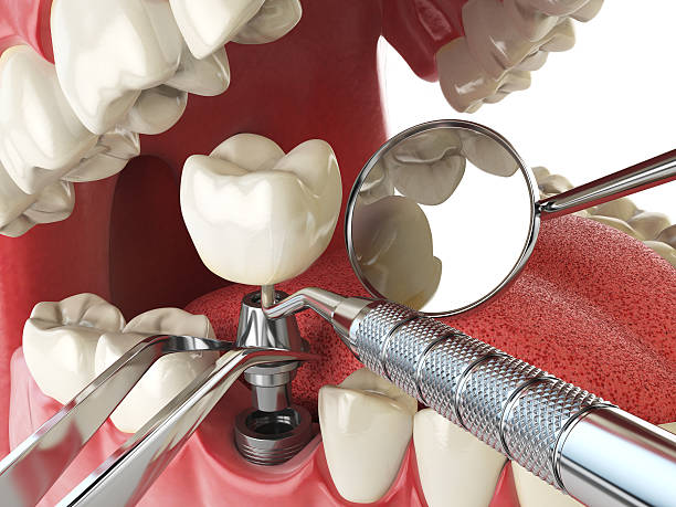 Best Emergency Treatment for Toothache in Newport, VT